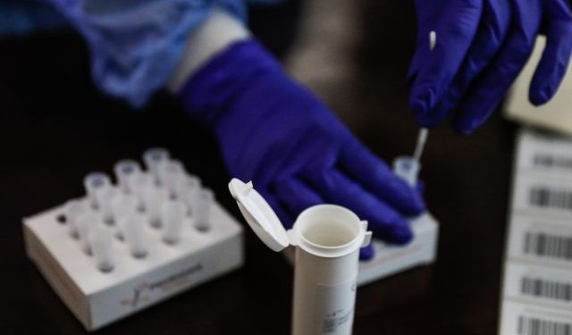 RAPID TEST ΓΙΑ ΚΟΡΟΝΟΪΟ(ΓΙΩΡΓΟΣ ΚΟΝΤΑΡΙΝΗΣ/EUROKINISSI)