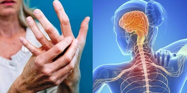 Παγκόσμια ημέρα Σκλήρυνσης κατά Πλάκας με δράσεις ενημέρωσης και ευαισθητοποίησης από την Ένωση Φίλων και Πασχόντων Β.Δ. Ελλάδας