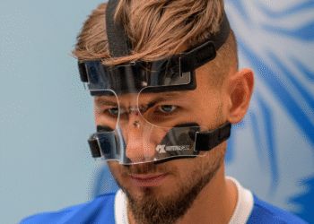 Με ειδική μάσκα ο Δόσης, οριστικά εκτός ο Παυλίδης