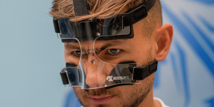 Με ειδική μάσκα ο Δόσης, οριστικά εκτός ο Παυλίδης